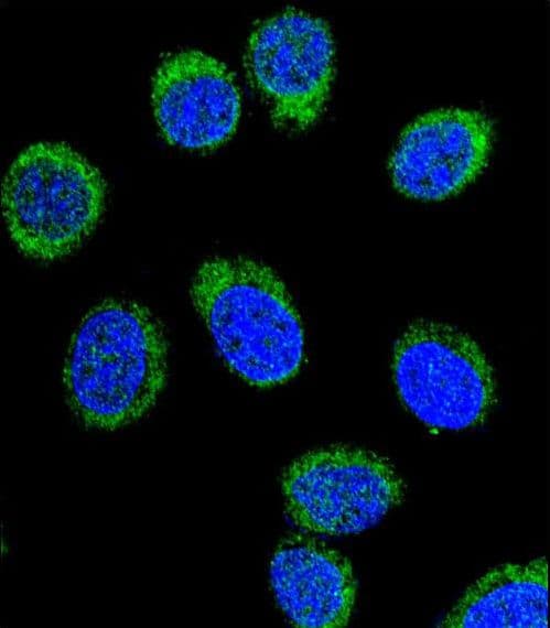 Polyclonal Rabbit anti-Human Antithrombin-III Antibody (aa364-393, IHC, IF, WB)
