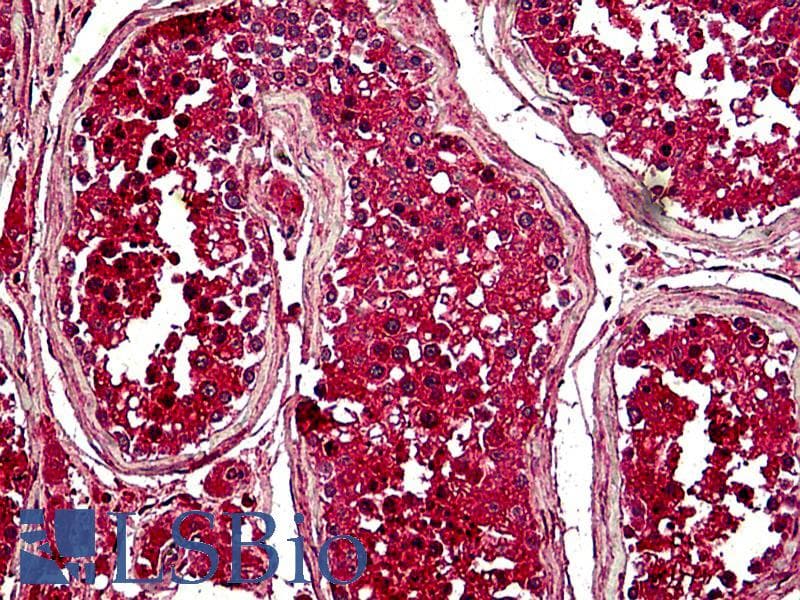 IHC-plus™ Securin / PTTG1 Antibody (aa148-160)