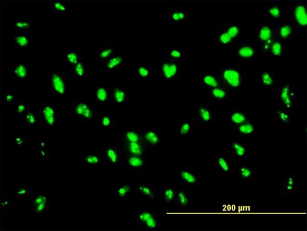 IHC-plus™ Monoclonal Mouse anti-Human UBTF / UBF Antibody (clone 2D8, IHC, IF, WB)