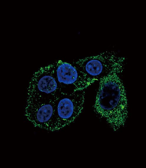 Polyclonal Rabbit anti-Human CYP2S1 Antibody (aa399-428, IHC, IF, WB)