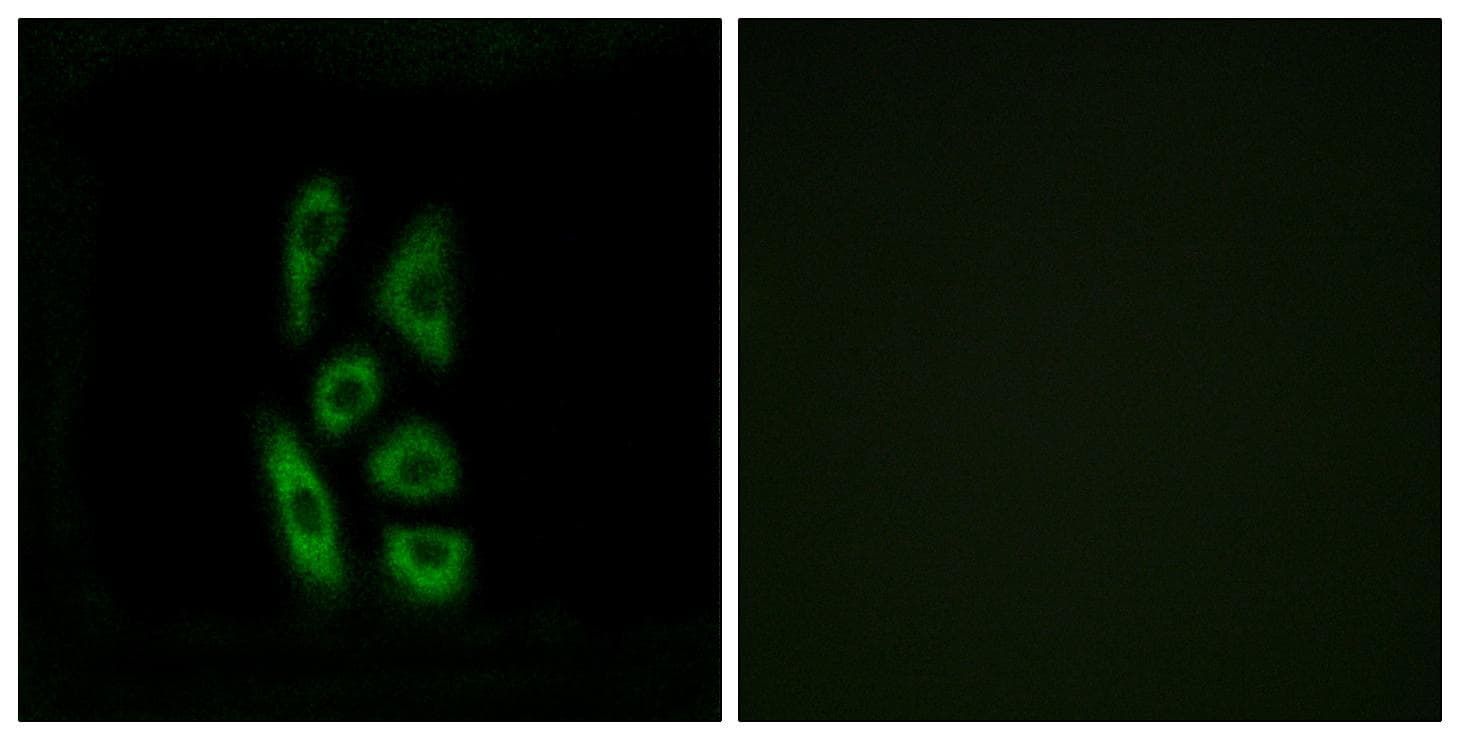 ACOT12 Antibody