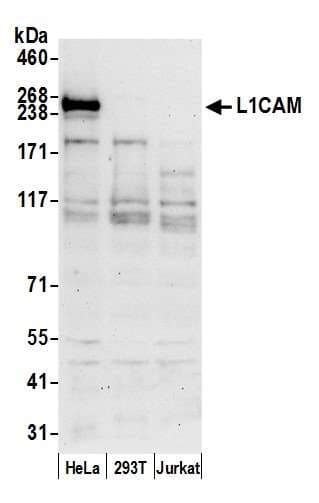 L1CAM Antibody (aa1-50)