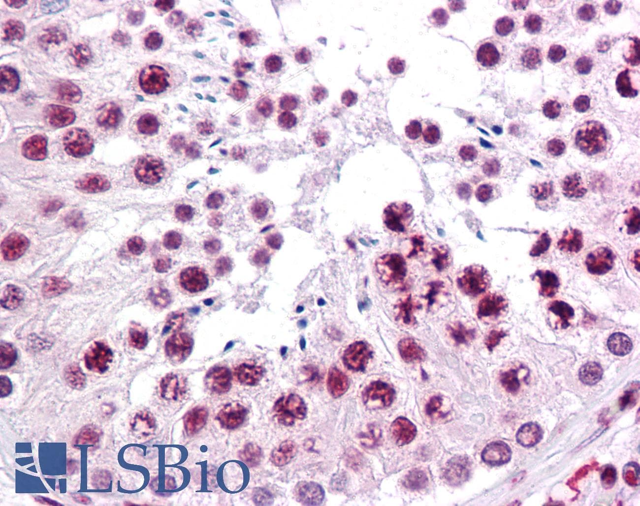 IHC-plus™ SIRT1 / Sirtuin 1 Antibody (clone 7B7)
