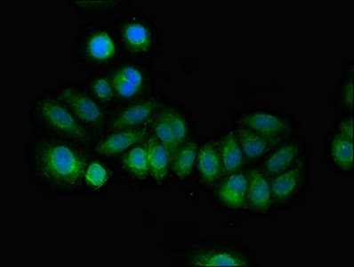 Polyclonal Rabbit anti-Human RCAN2 / RCN2 Antibody (IHC, IF, WB)