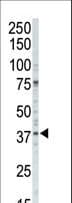 Polyclonal Rabbit anti-Human CSNK1A1 / CK1 Alpha Antibody (aa309-337, IHC, WB)