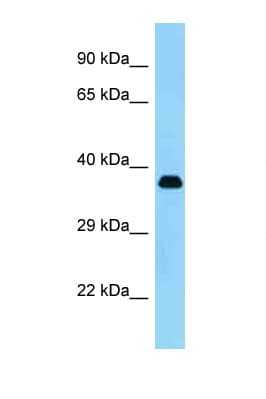 KERA / Keratocan Antibody (aa196-245)