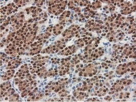 SMS / Spermine Synthase Antibody (clone OTI2G8)