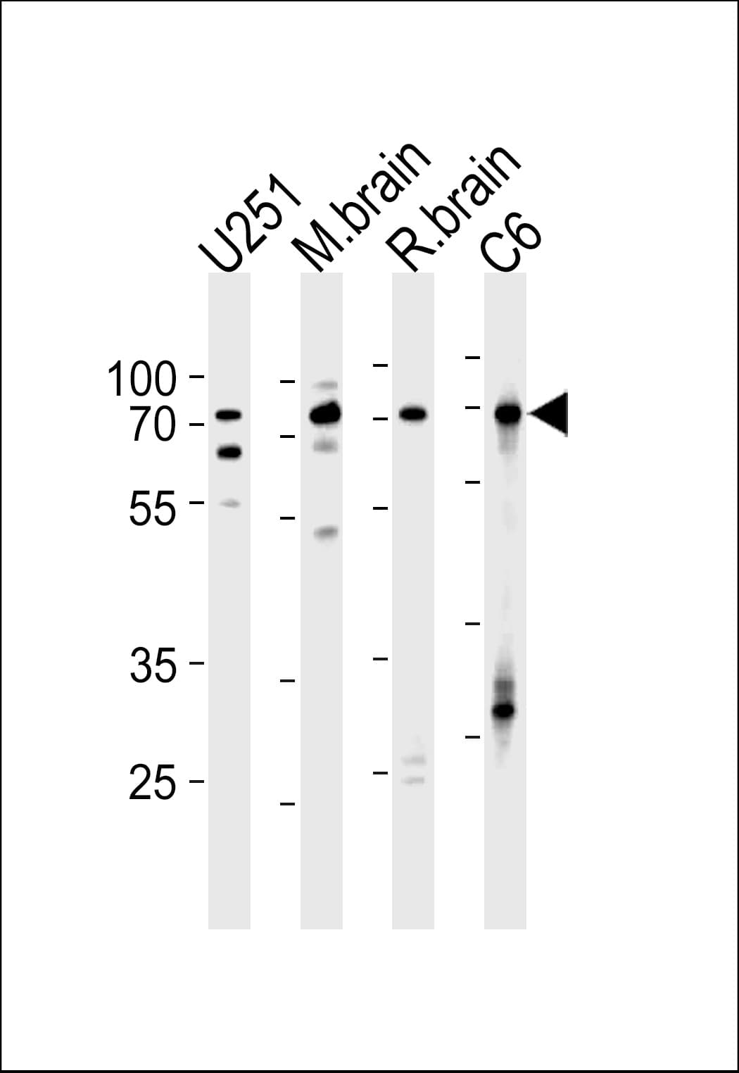 FUBP1 Antibody (aa240-268)