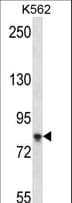 SAMD4B Antibody (aa414-442)