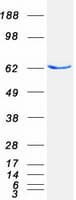 Human ASNS Protein (Recombinant Myc-DDK (Flag))
