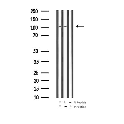 AR / Androgen Receptor Antibody (phospho-Ser650)