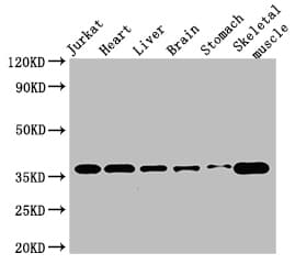 Polyclonal Rabbit anti-Human USE1 / p31 Antibody (IF, WB)