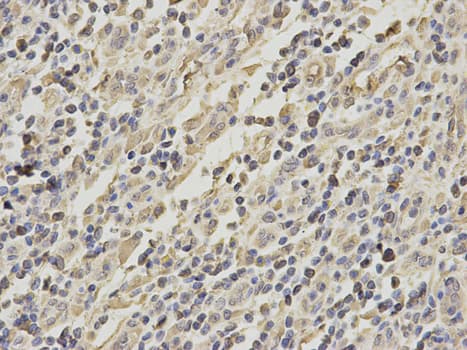 GRIA3 / GLUR3 Antibody
