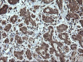 STK38L / NDR2 Antibody (clone OTI4D8)
