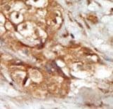 MAP3K14 Antibody (aa119-148)