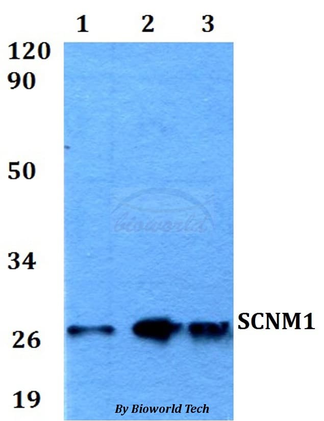 SCNM1 Antibody