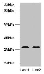 IHC-plus™ Adiponectin Antibody