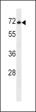 SLC7A1 / CAT1 Antibody (aa429-457)