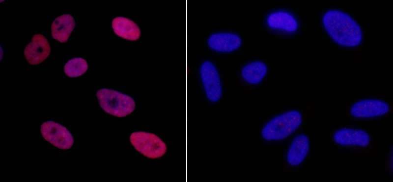 Polyclonal Rabbit anti-Human TRIM28 / KAP1 Antibody (phospho-Ser824, IF)