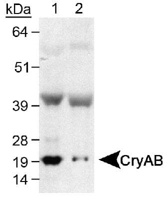 CRYAB / Alpha B Crystallin Antibody (Internal, Biotin)