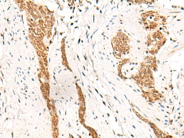 HOXC13 Antibody
