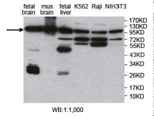 AP2B1 Antibody (aa737-950)