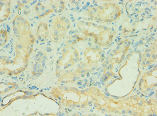 C4BPB / C4BP Beta Antibody (aa18-252)