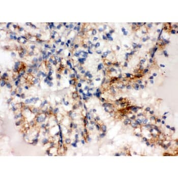 Polyclonal Rabbit anti-Human SULT2A1 / Sulfotransferase 2A1 Antibody (aa253-285, IHC, WB)