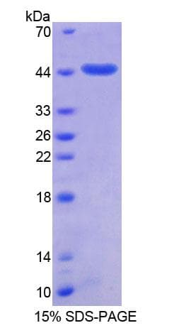 Human SUMO2 Protein (Recombinant His-GST)