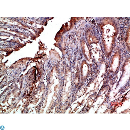 Polyclonal Rabbit anti-Human NOX1 Antibody (IHC, WB)