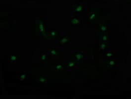 Monoclonal Mouse anti-Human RAB30 Antibody (clone OTI3F4, IF, WB)