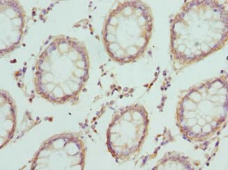CRTAP Antibody