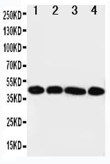 IL3RA / CD123 Antibody (aa135-151)