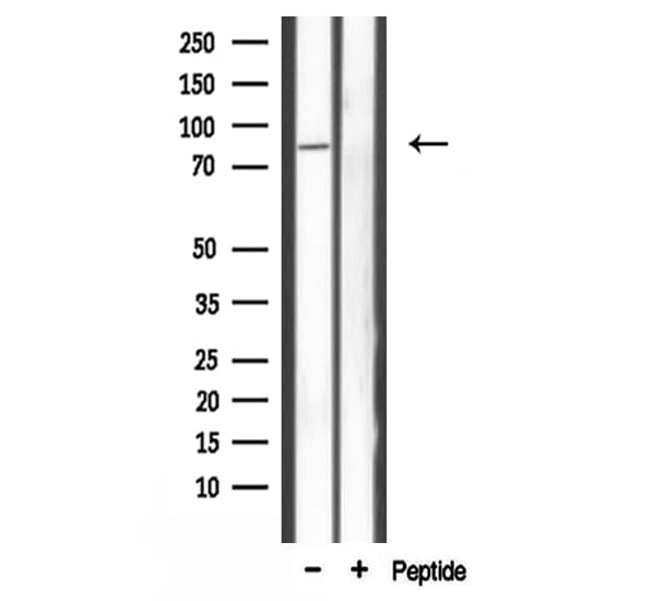 CARF / ALS2CR8 Antibody