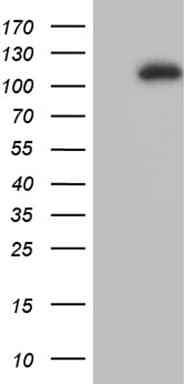 Monoclonal Mouse anti-Human L3MBTL3 Antibody (clone OTI1B5, aa98-319, WB)