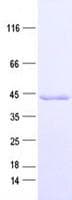 Human OTC Protein (Recombinant His, N-Terminal)