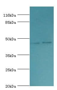 Polyclonal Rabbit anti-Human SERPINH1 / HSP47 Antibody (aa139-418, IHC, WB)
