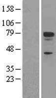 TP73 / p73 Protein (Over-Expression Lysate Myc-DDK (Flag))