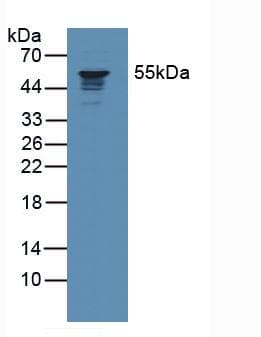 CORO1A / Coronin 1a Antibody (aa7-204)