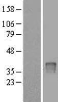 UP2 / UPP2 Protein (Over-Expression Lysate Myc-DDK (Flag))