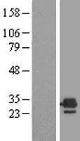 ETFB Protein (Over-Expression Lysate Myc-DDK (Flag))