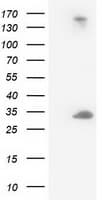 DCK / Deoxycytidine kinase Antibody (clone OTI16G6, Carrier-free)