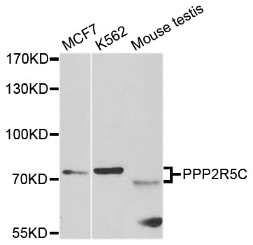 Polyclonal Rabbit anti-Human PPP2R5C Antibody (IHC, WB)