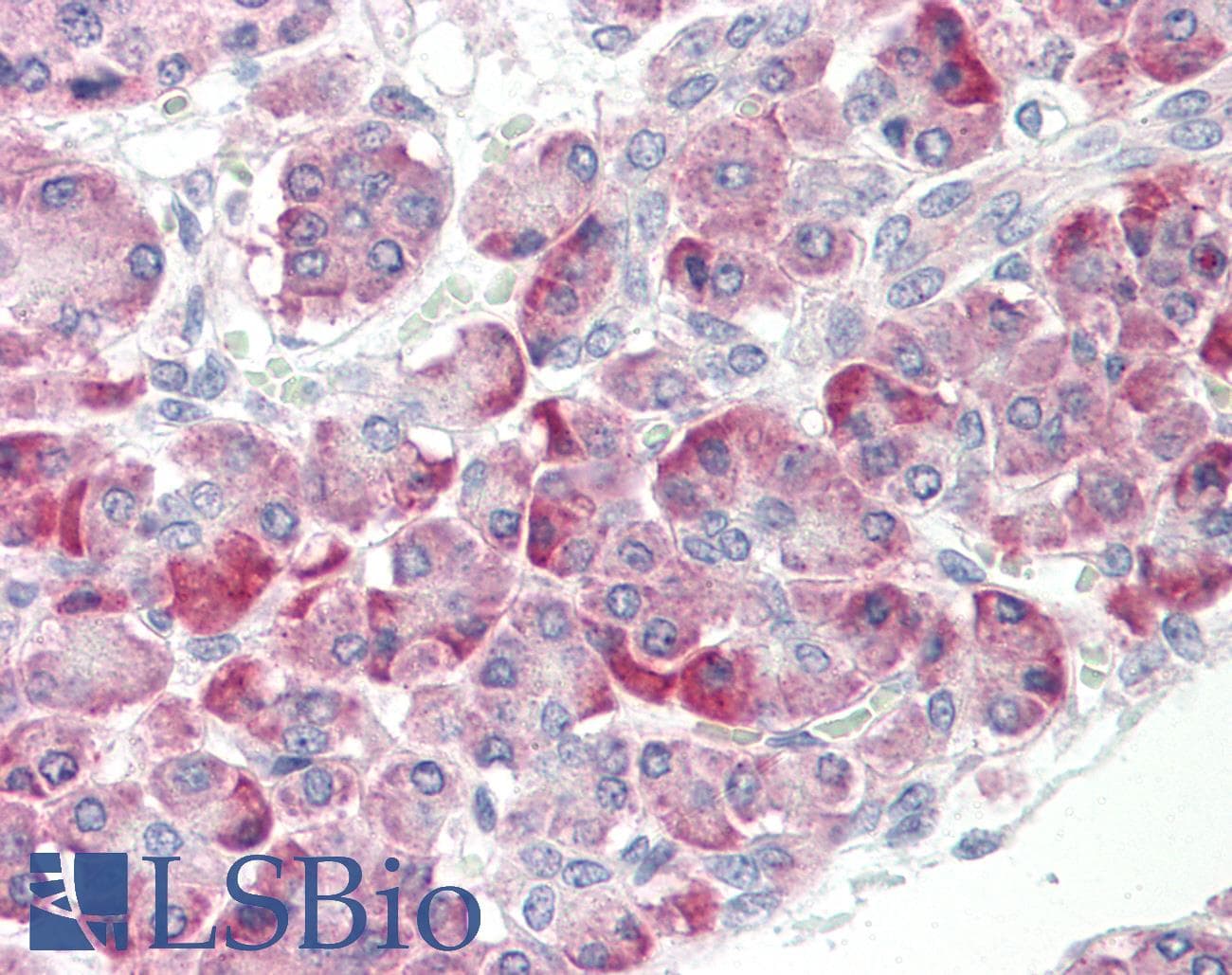 IHC-plus™ HSPH1 / HSP105 Antibody (aa791-840)