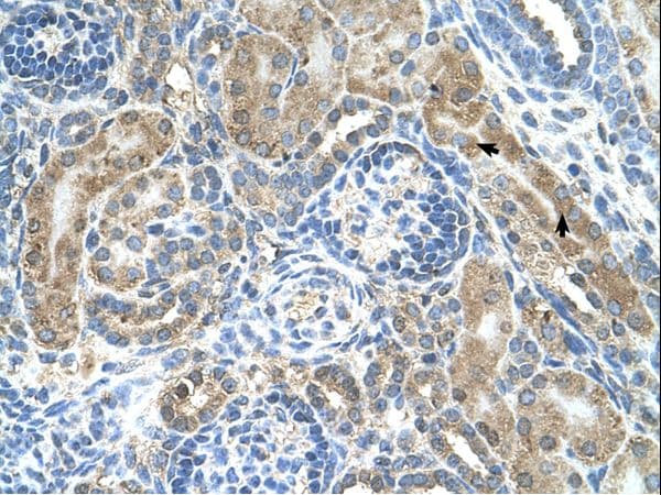 Polyclonal Rabbit anti-Human CRELD1 Antibody (aa311-360, IHC, WB)