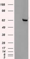 CHEK2 / CHK2 Antibody (clone OTI4C10)