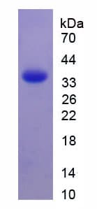 Rat TFPI / LACI Protein (Recombinant His)