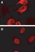 BAG2 Antibody