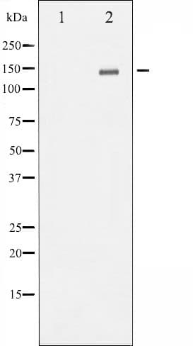 Polyclonal Rabbit anti-Human GRIN2B / NMDAR2B / NR2B Antibody (phospho-Tyr1336, IHC, IF, WB)