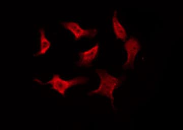 CASP8 / Caspase 8 Antibody (Cleaved Asp384)